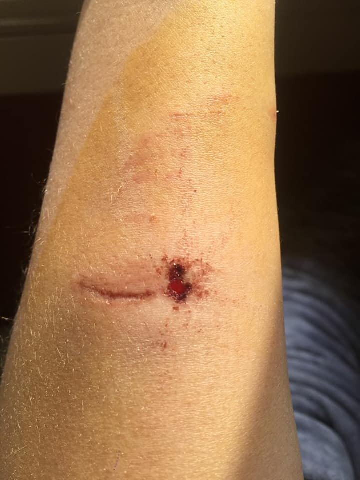 كلاب ضالة فى نادى الصيد