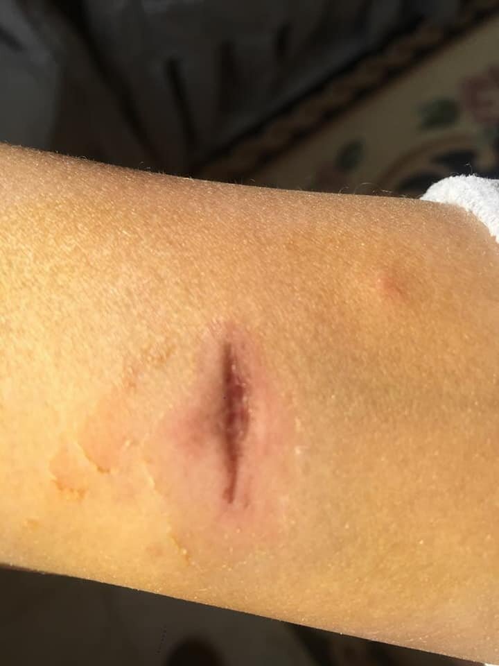 كلاب ضالة فى نادى الصيد